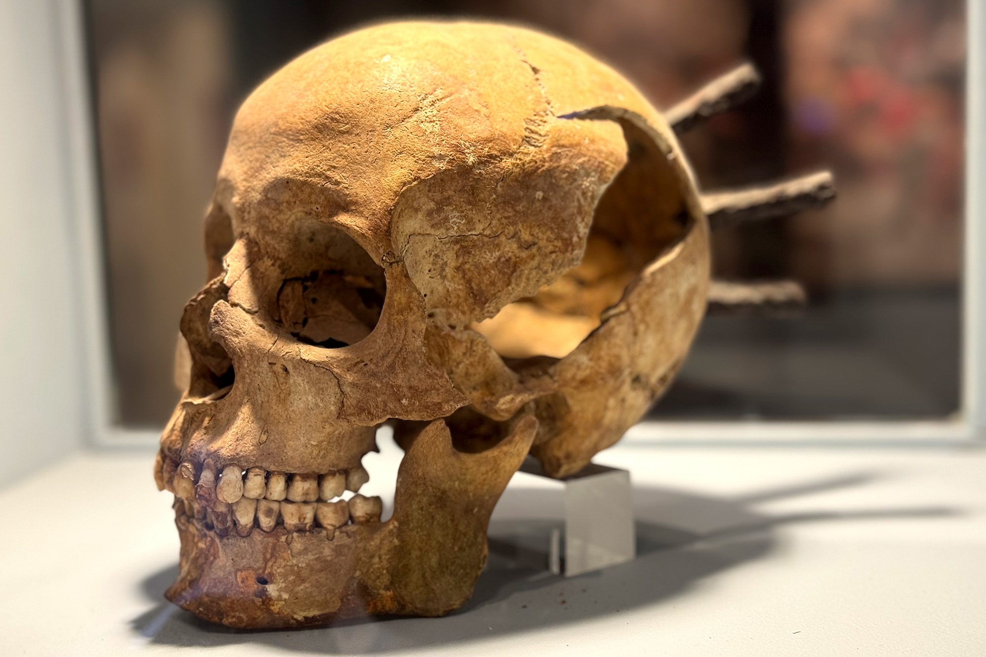 Skelett. Ett kranium. tre pilar i huvudet. Monter på ett museum.